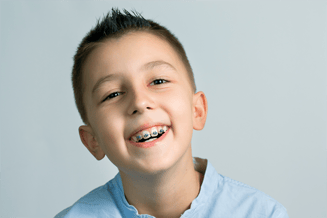 Benefits-of-Early-Orthodontic